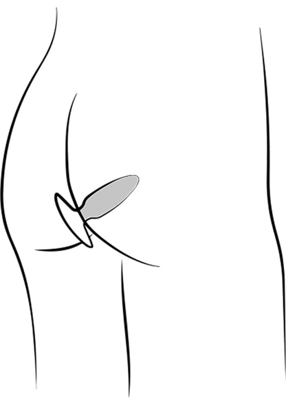 Vibrerende anaalplug, blauwe punt met gele basis, schematische weergave van inbrengen.