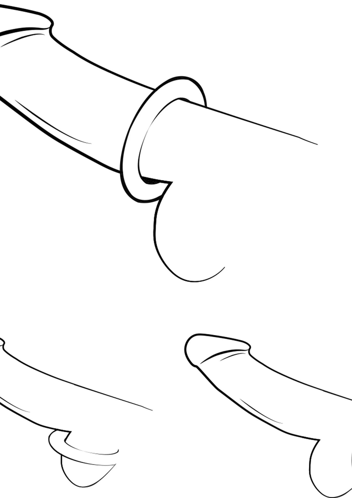 Illustratie van cockrings: twee ringen worden aangebracht op de schacht